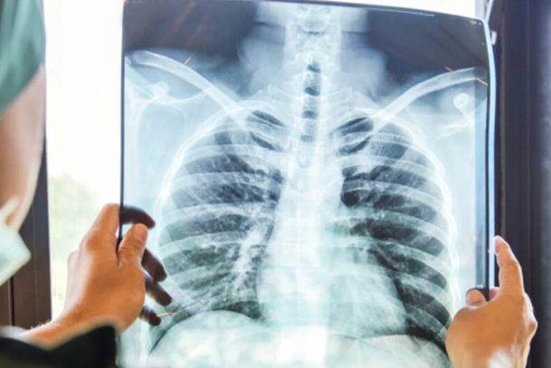 Maroc : l’Intelligence Artificielle au Chevet de la Santé